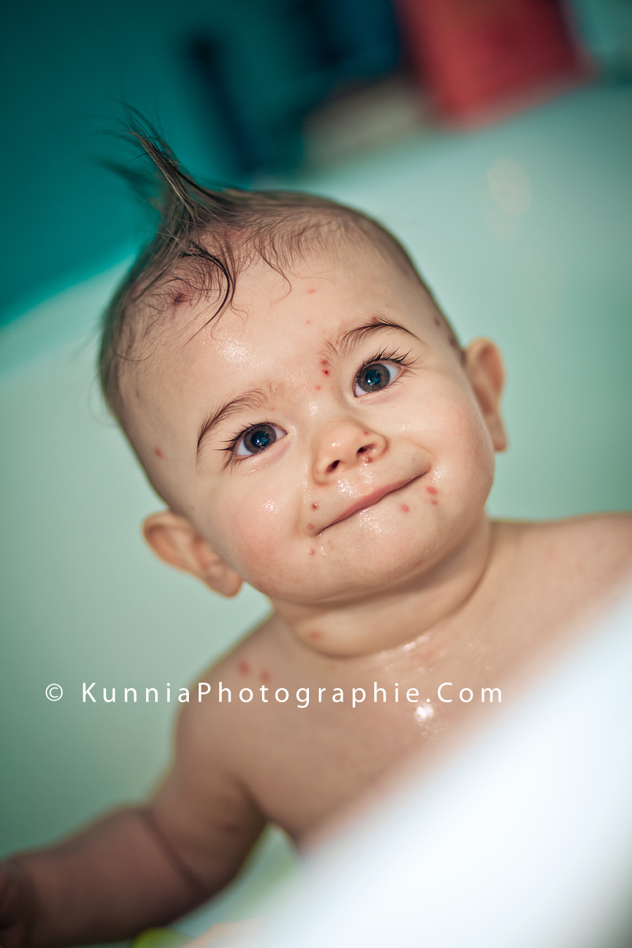 bébé qui a la varicelle dans son bain